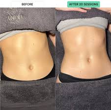 Steam Sauna for Weight Loss: How Canadians Can Support Fat Loss Naturally at Home