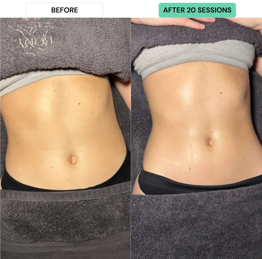 Does a Steam Sauna Burn Calories? A Canadian's Guide to Relaxation and Fat Burn - AURAPRO SAUNA™