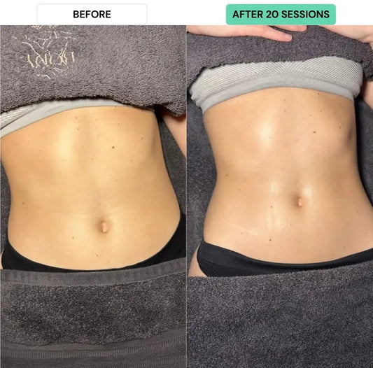 Does a Steam Sauna Burn Calories? A Canadian's Guide to Relaxation and Fat Burn - AURAPRO SAUNA™